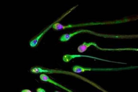 Più longevi gli uomini che hanno una migliore qualità del seme