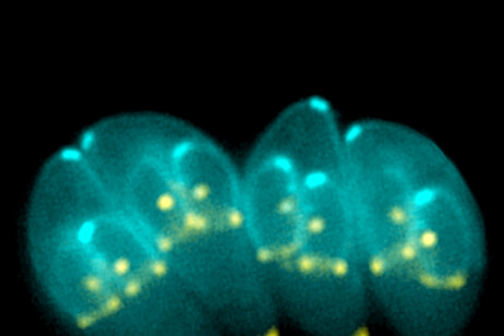 Batteri Toxoplasma gondii (fonte:  Ke Hu e John M. Murray, da Wikimedia)