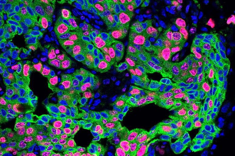 Le metastasi aumentano fino a quattro volte nei topi sottoposti a stress cronico (fonte: Egeblad lab/Cold Spring Harbor Laboratory) - RIPRODUZIONE RISERVATA