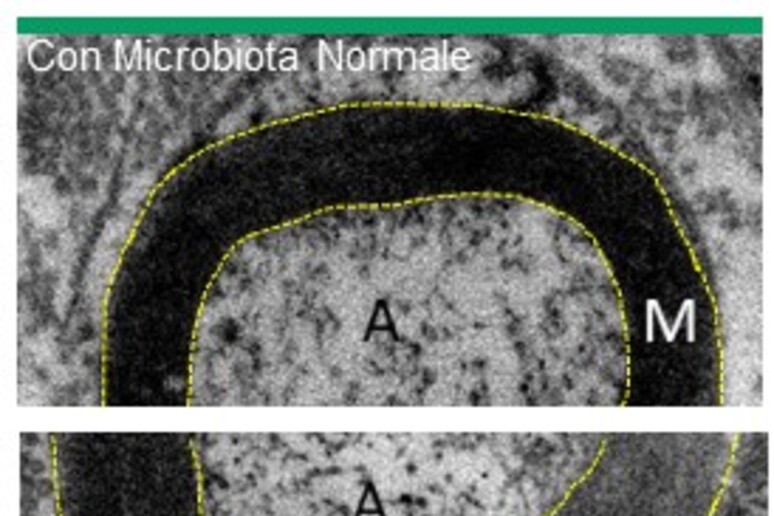 I nervi che si sono sviluppati in assenza di microbiota hanno una guaina mielinica più spessa (fonte: Stefania Raimondo - Giulia Ronchi - Giovanna Gambarotta (NICO-UNITO)) - RIPRODUZIONE RISERVATA