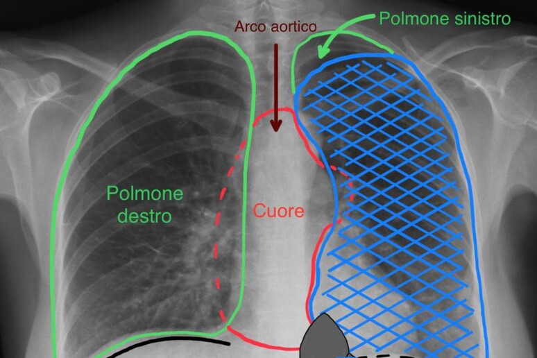 - RIPRODUZIONE RISERVATA